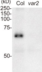 FtsH1 + FtsH5 | ATP-dependent zinc metalloprotease FtsH1 + FtsH5 (chloroplastic) in the group Antibodies Plant/Algal / Photosynthesis / Proteases at Agrisera AB (Antibodies for research) (AS16 3930)